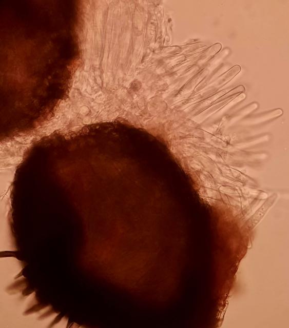 Pseudotecija u kategoriji 0, Venturia inaequalis, Čađava pegavost lišća i krastavost plodova jabuke, Apple scab	
