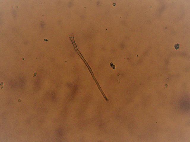 Cercospora beticola, konidije
