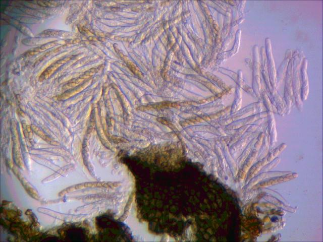 Askospore i pseudotecija Venturia inaequalis