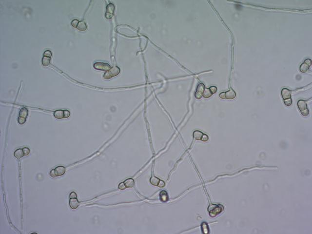 Oslobođene askospore Venturia inaequalis u laboratoriji