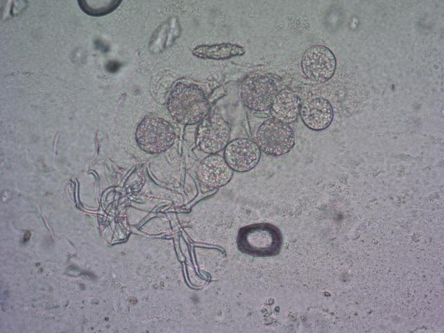 konidije Pseudoperonospora parasitica