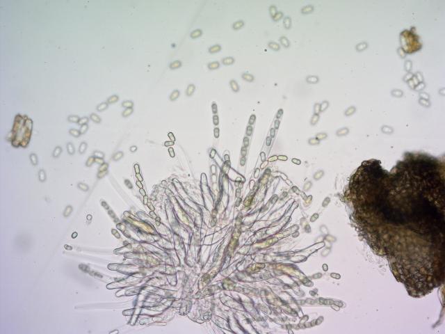 Zrele askospore u askusima 