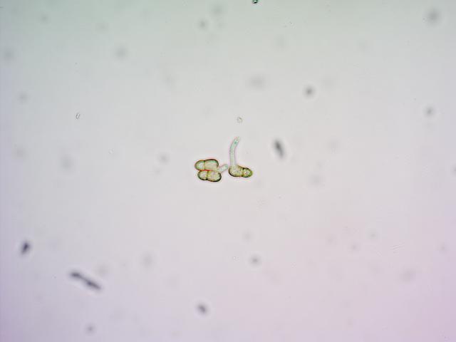 Oslobođene askospore u laboratoriji