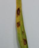 Rhynchosporium secalis