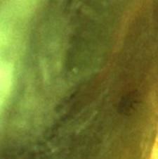 pregled pupoljaka pod binokularom, larve kruškine buve (Cacopsylla pyri)